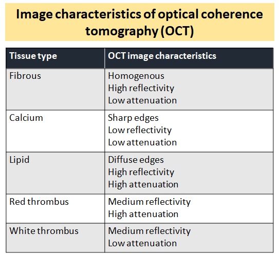 Image characteristics of optical coherence tomography 